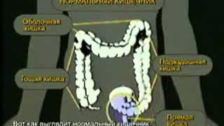 Очистка кишечника. Wellness. Agel. Юлия Никитеннко.