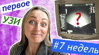 7 неделя  ПЕРВОЕ УЗИ идем В БОЛЬНИЦУ на учет - женская консультация