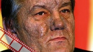 Новые факты отравления Виктора Ющенко