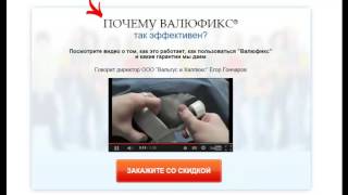 Смотреть Вальгусная Деформация Стопы. На Ногах Растут Шишки - Почему Растет Кость На Ноге