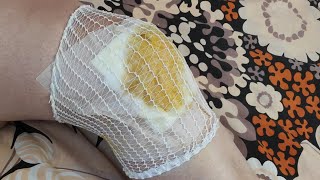 Шок!! Этот состав лечит и уберёт боль в колене. Рецепты китайской медицины