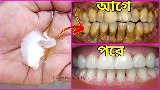 এটি দিয়ে মাত্র একবার দাঁত মাজুন।দাঁতের সকল ব্যাথা ও হলদে দূর হবে গ্যারান্টি।কালো দাঁত সাদা করুন।
