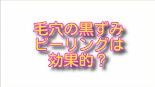 毛穴の黒ずみにピーリングは効果的？いちご鼻で悩んだ元ヘアメイクが解説！