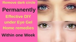 How to remove dark circle under eyes permanently - within 1 week, DIY, under eye gel home remedies