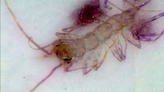 ASTRALINIAI PARAZITAI: KAIP JŲ ATSIKRATYTI ?