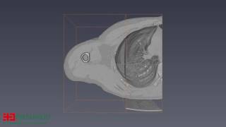 PRESURG3D 3D