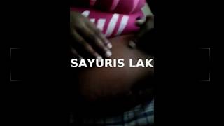 SAYURIS LAK AMPUTEE