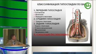 Яцык С П - Ранняя диагностика и коррекция патологии половых органов у детей как профилактика наруш