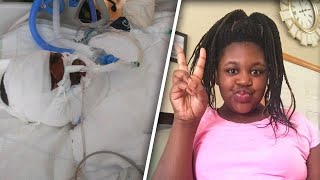 12-Year-Old Girl Seriously Burned During 'Fire Challenge'