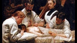 Рак легкого, академик М.И.Перельман © Lung cancer