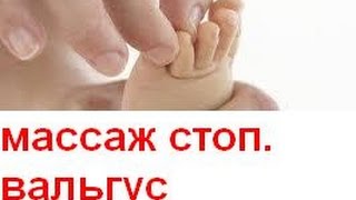 Массаж при вальгусной стопе у детей в кабинете ЛФК, г. Киев