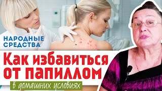 КАК ИЗБАВИТЬСЯ от ПАПИЛЛОМ в домашних условиях || народные средства