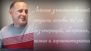 Лечение злокачественной опухоли головного мозга 6х7 см без операций, облучения, химиотерапии