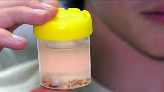 Teen's legs attacked by tiny parasites