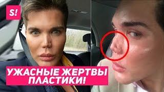 САМЫЕ ЖУТКИЕ ЖЕРТВЫ ПЛАСТИКИ / ЖИВЫЕ "КЕНЫ" ??