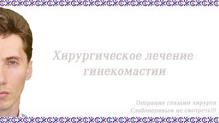 Хирургическое лечение гинекомастии в г. Краснодаре. Пластический хирург Суходолов Я.И.
