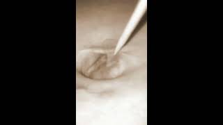 More extreme bellybutton poking with a toothpick