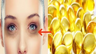 চোখের নিচের কালো দাগ দূর করার ১০০ ভাগ সহজ ও কার্যকর উপায়