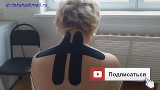 ШЕЙНЫЙ ОСТЕОХОНДРОЗ | Тейпирование | Kinesio taping
