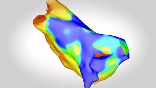 Cardiac Interventions: Guy's and St Thomas' NHS Foundation Trust & King’s College London