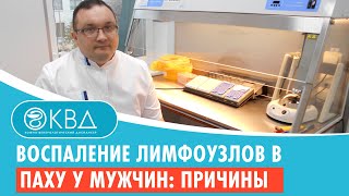 Воспаление лимфоузлов в паху у мужчин причины