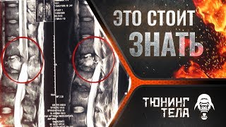 ТРАНСФОРМАЦИЯ ТЕЛА - ЧТО СТОИТ ЗНАТЬ ПРИ ТРАВМЕ СПИНЫ / ТЕЛО К ЛЕТУ #7 - Укрепление мышц спины
