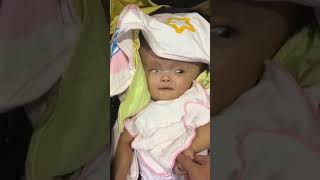Bé Thành bị não úng thủy - Hành trình chữa bệnh