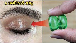মাত্র ৩ দিনে চোখের কালো দাগ(Dark Circle)দূর করে দেবে-dark circle remove home remedy