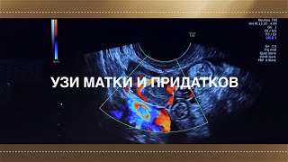 УЗИ МАТКИ И ПРИДАТКОВ