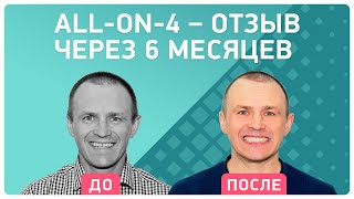 Имплантация ALL-ON-4® на имплантах Nobel ? спустя 6 месяцев после лечения