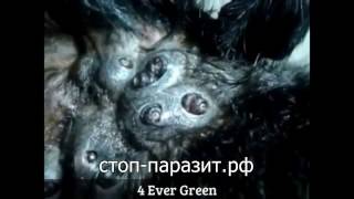 Страшный подкожный паразит пожирает плоть. Манговый червь.