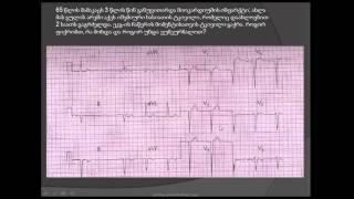 II ხარისხის ატრიოვენტრიკულური ბლოკადა (მობიტცი  2) / ჰისის კონის მარცხენა ფეხის წინა ტოტის ბლოკადა