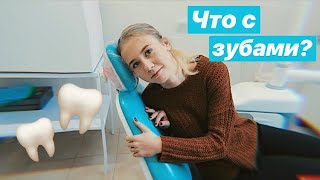 VLOG: ПРО БРЕКЕТЫ И ЗУБЫ МУДРОСТИ. АЛЛЕРГИЯ