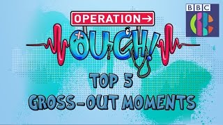 Operation Ouch | Top 5 Gross-out Moments | CBBC