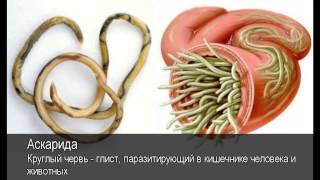 Аскарида. Толковый Видеословарь русского языка