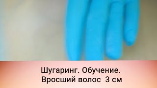 Шугаринг. Обучение. Как достать вросший волос в зоне бикини 3 см