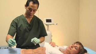 LipoLite Laser Lipo Sculpture Shirley Ballas, Dr. John Shieh MD, RejuvaYou - Liposuction Alternative