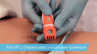 Обучение шугарингу в зоне бикини