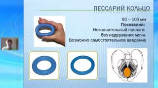 Черная Н. Е. Тонкое и толстое кольцо пессарии