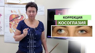 Коррекция косоглазия