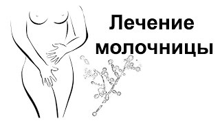 Молочница — лечение молочницы