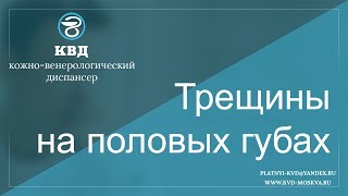 535  Трещины на половых губах