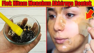 SUDAH DIBUKTIKAN JUTAAN ORANG, FLEK HITAM MENAHUN SEKALIPUN HILANG DENGAN RACIKAN INI