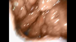 Short video in friends mouth vore