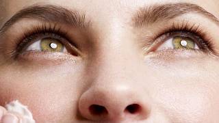 Under Eye Dark Circles - Some Causes & Treatments Tutorial