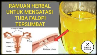 CARA ALAMI MENGATASI TUBA FALOPI NON PATEN  SECARA ALAMI DENGAN RAMUAN HERBAL