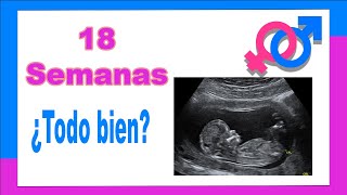 Eco 18 semanas emabarazo, comentado por el el mejor ginecólogo