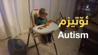 چۆن نه‌خۆشیی ئۆتیزم له‌منداڵدا ده‌ناسیته‌وه‌؟ نیشانه‌كانی نه‌خۆشیی ئۆتیزم چین؟