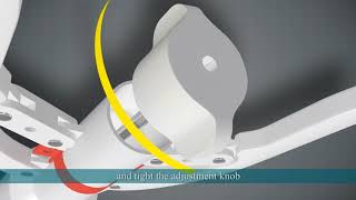 LangHe Medical — Disposable Circumcision Suture Device Operation Video - Demo