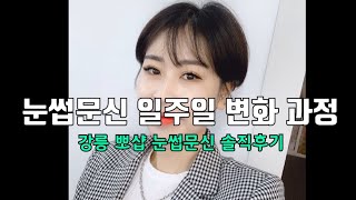 [리뷰] 강릉 눈썹문신 일주일 변화 과정 / (강릉 뽀샵 솔직 후기 ) 눈썹문신은 안아플꺄?